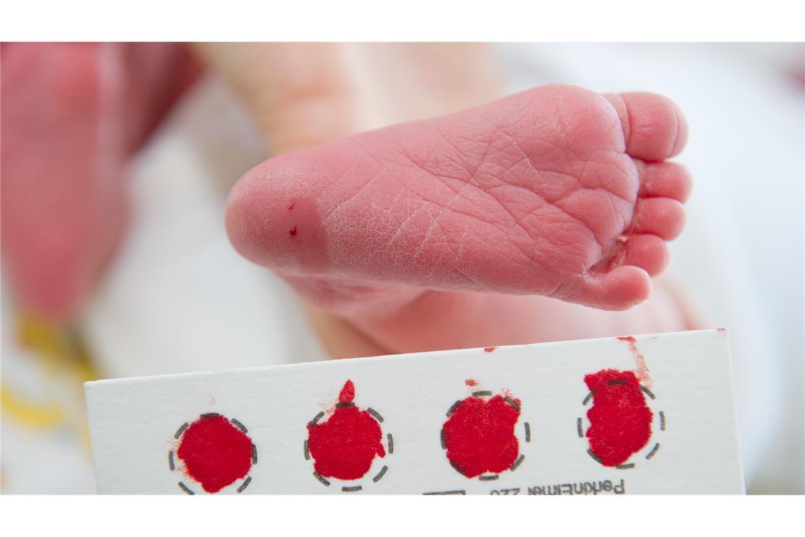 Wie funktioniert das Baby-Screening bei Krankheiten An der Universitätsklinik in Greifswald (Mecklenburg-Vorpommern) wird am Fuß eines Babys Blut für ein Neugeborenen-Screening abgenommen.