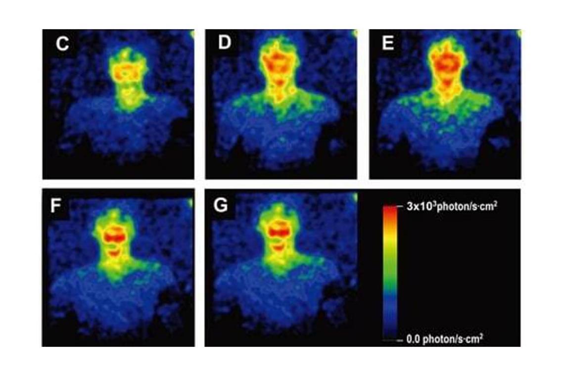 Andere Forscher haben die ultraschwache Photonenemissionen schon vor einigen Jahren (wie hier im Jahr 2021) nachgewiesen.