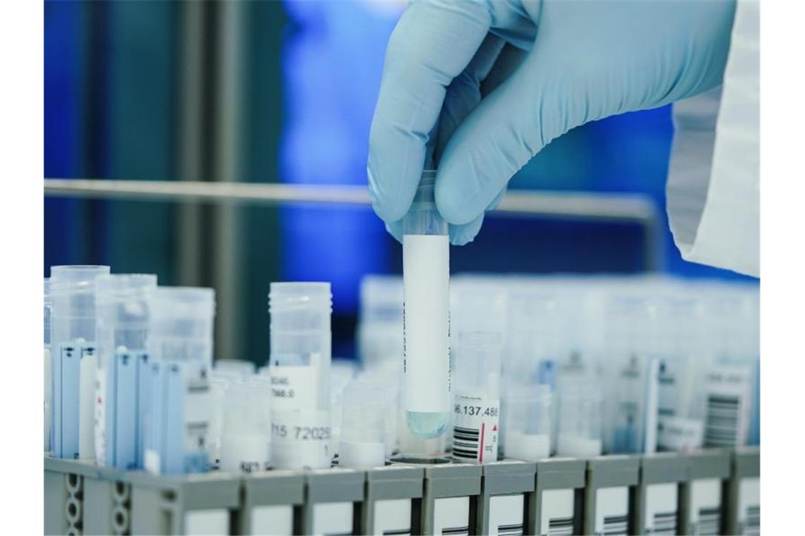 Corona-Beratungen: Diese Fragen müssen geklärt werden Angesichts der sich rasant ausbreitenden Omikron-Variante des Coronavirus hat der Laborverband ALM einen Höchstwert an PCR-Testungen pro Woche verzeichnet. Foto: Uwe Anspach/dpa