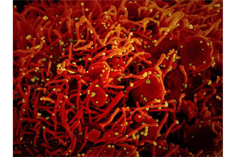 Aufnahme eine Zelle (rot), die mit dem Coronavirus (SARS-CoV-2, gelb) infiziert ist. Foto: Niaid/Europa Press/dpa