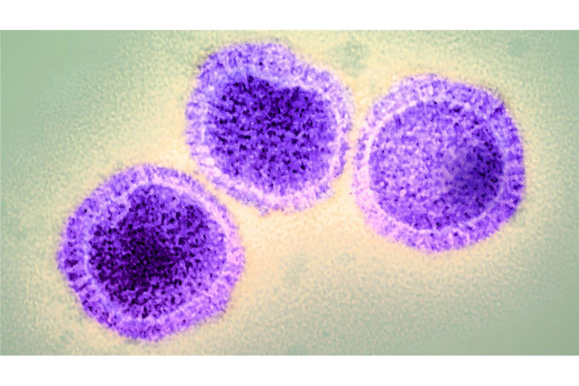RKI warnt vor neuer Grippewelle Aufnahme von Influenza-Viren mit dem Elektronenmikroskop.