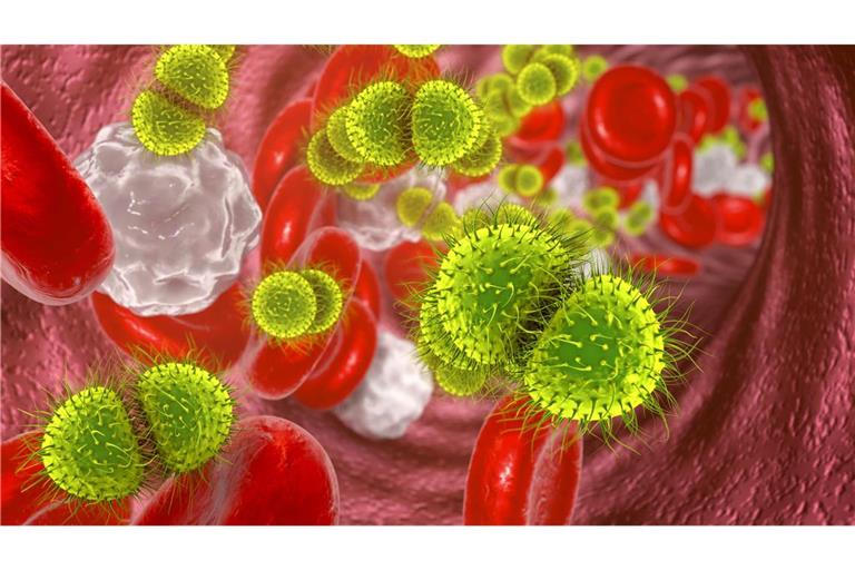 Meningokokken-Infektion - die unterschätzte Gefahr Bakterien der Gruppe „Neisseria meningitidis“, auch Meningokokken genannt, verursachen eine eitrige Hirnhautentzündung (Meningitis), mitunter auch eine Blutvergiftung (Sepsis).