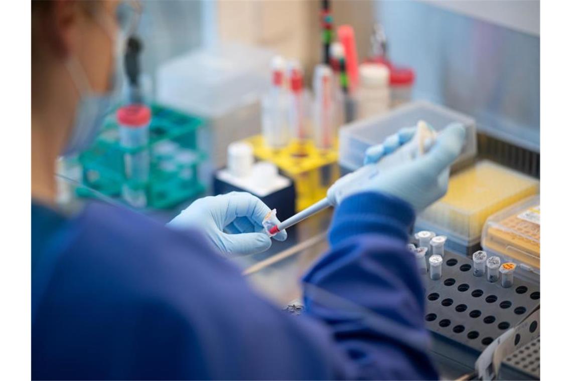 Zahl an PCR-Tests sinkt weiter: Positivrate auf Rekordhoch Bei der aktuell hohen Positivrate bei PCR-Tests muss auch von einer hohen Dunkelziffer ausgegangen werden. Foto: Daniel Reinhardt/dpa