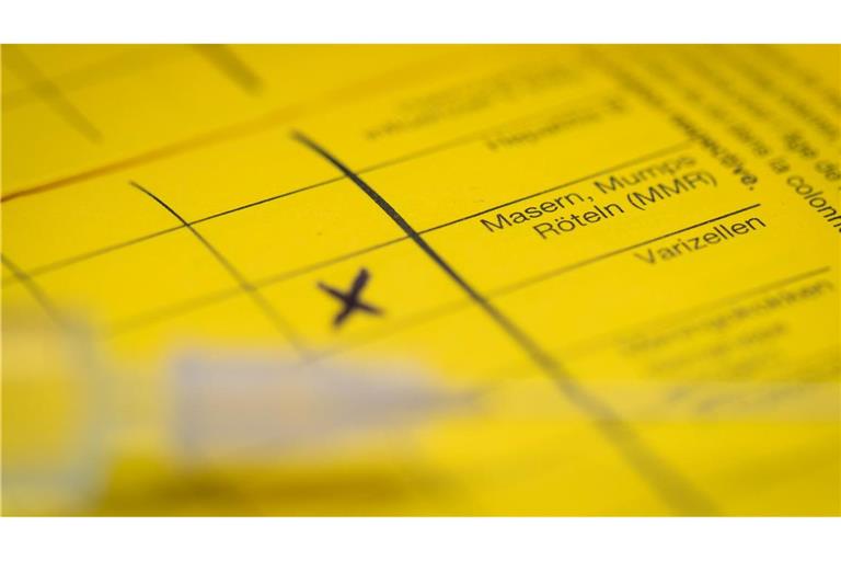 Bei Masern zeigt sich erst oft Fieber, bevor später ein Hautausschlag dazukommt. (Symbolbild)