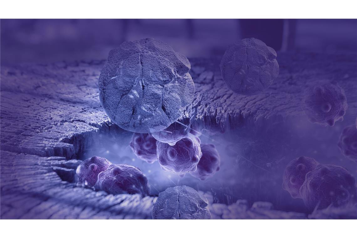 Wie Stress Krebs und Metastasen verursachen kann Besonders heimtückisch ist Stress, wenn man Krebs (auf dem Bild sind Krebszellen in 3D-Darstellung abgebildet) hat. Denn die Stresshormone können die Wachstumsprozesse in Tumorzellen aktivieren und so die Metastasierung begünstigen.