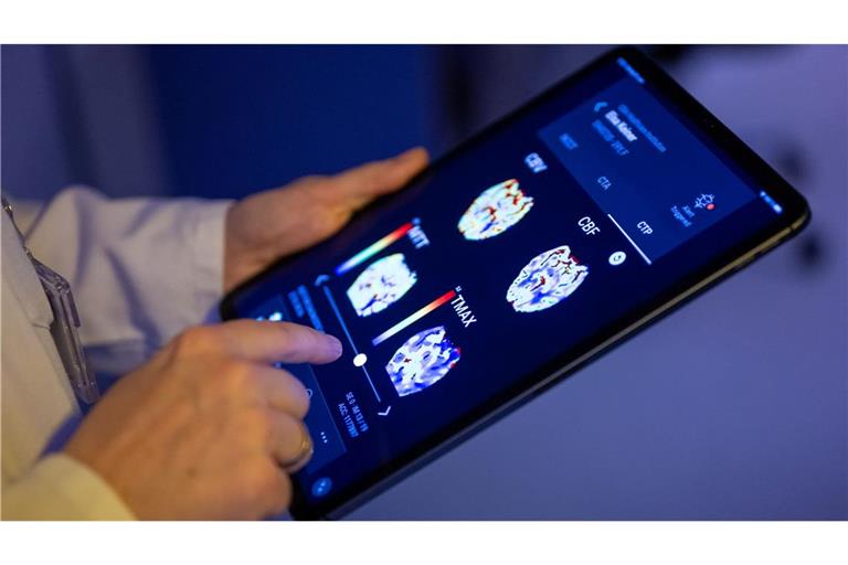 Besonders im Gesundheitswesen sieht die EU-Kommission große Potenziale durch KI. (Symbolbild)