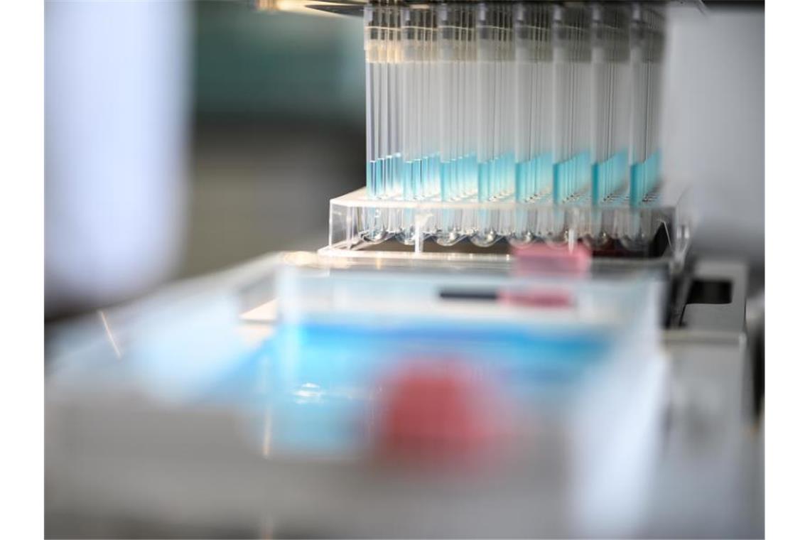 Chemiebranche dank Corona im Plus Blaue Flüssigkeit wird in einem Labor pipettiert. Foto: Sebastian Gollnow/dpa/Symbolbild