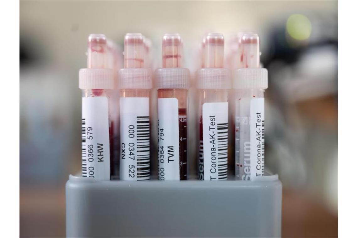 Blutentnahmeröhrchen mit Blutproben für einen Corona-Antikörper-Test stehen in einem Rack. Foto: Marijan Murat/dpa/archiv