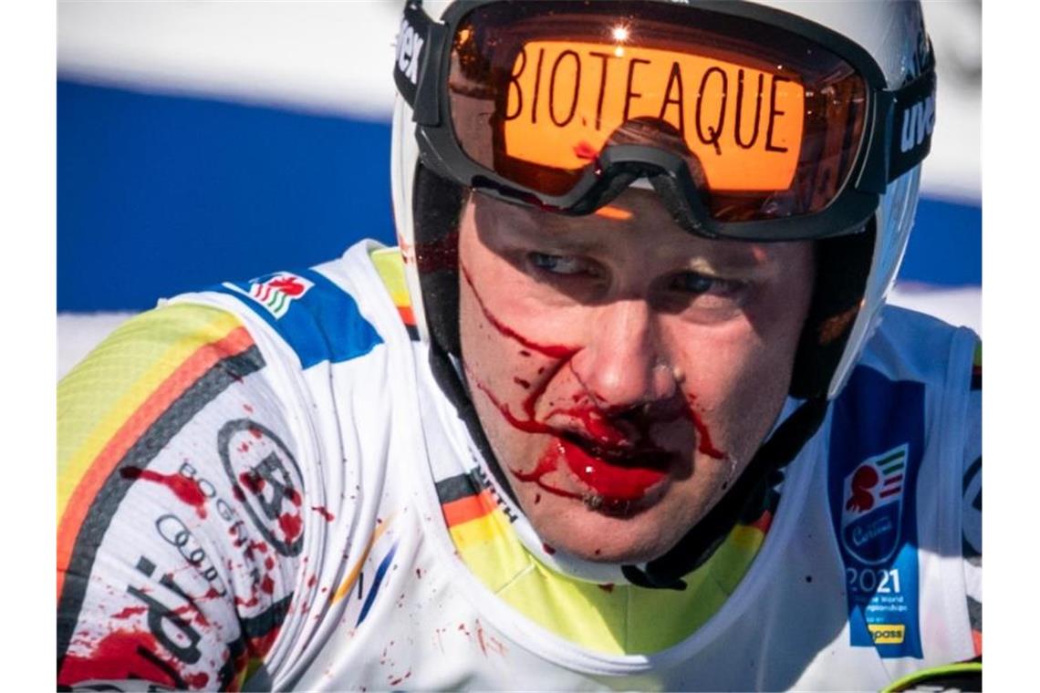 Sander sorgt für nächstes Ski-Märchen: Silber in Abfahrt Bomed Baumann zog sich bei seinem Sturz im Ziel leichte Schnittwunden im Gesicht zu. Foto: Michael Kappeler/dpa