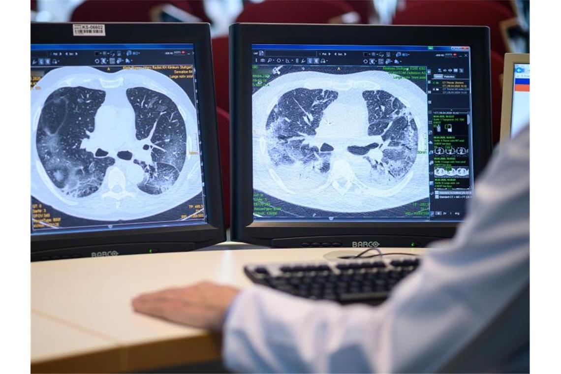 Computertomographieaufnahmen zeigen die Lunge eines Covid-19-Patienten. Foto: Sebastian Gollnow/dpa