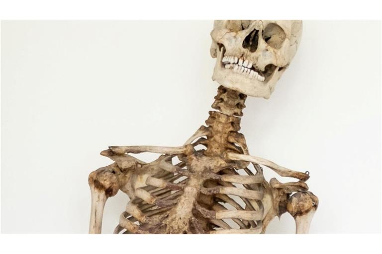 Dank wissenschaftlicher Analysen und eines Verwandten weiß man nun, dass dieses Skelett die sterblichen Überreste des Räubers Schinderhannes sind.