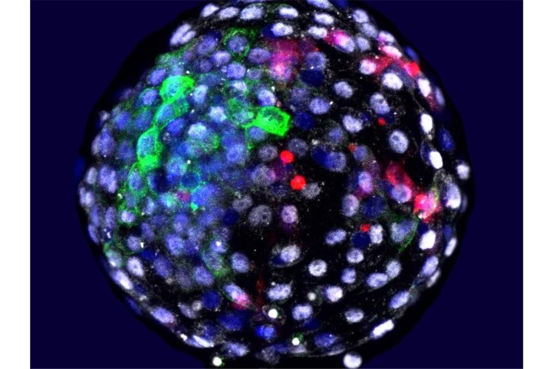 Forscher erzeugen Mischwesen aus Mensch und Affe Das Bild zeigt eine Chimäre Mensch-Affe-Blastozyste. Wissenschaftler haben Embryonen aus Zellen von Mensch und Affe erzeugt. Foto: Weizhi Ji/Kunming University of Science and Technology/dpa