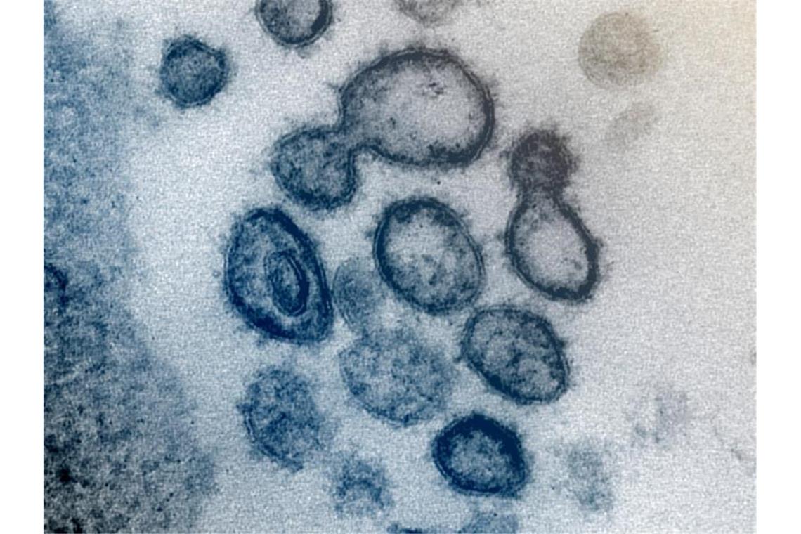 Das neuartige Coronavirus SARS-CoV-2 unter dem Elektronenmikroskop. Foto: Uncredited/NIAID-RML/AP/dpa/Archivbild