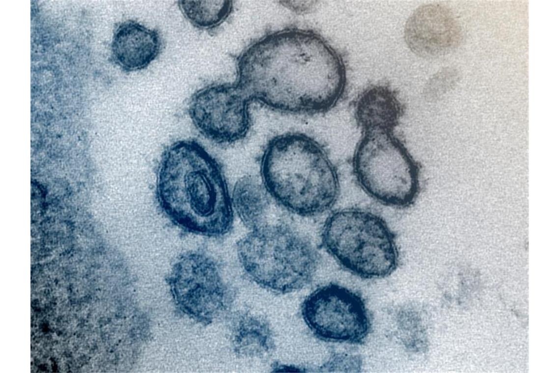 Das neuartige Coronavirus SARS-CoV-2 unter dem Elektronenmikroskop. Foto: Uncredited/NIAID-RML/AP/dpa/Archivbild