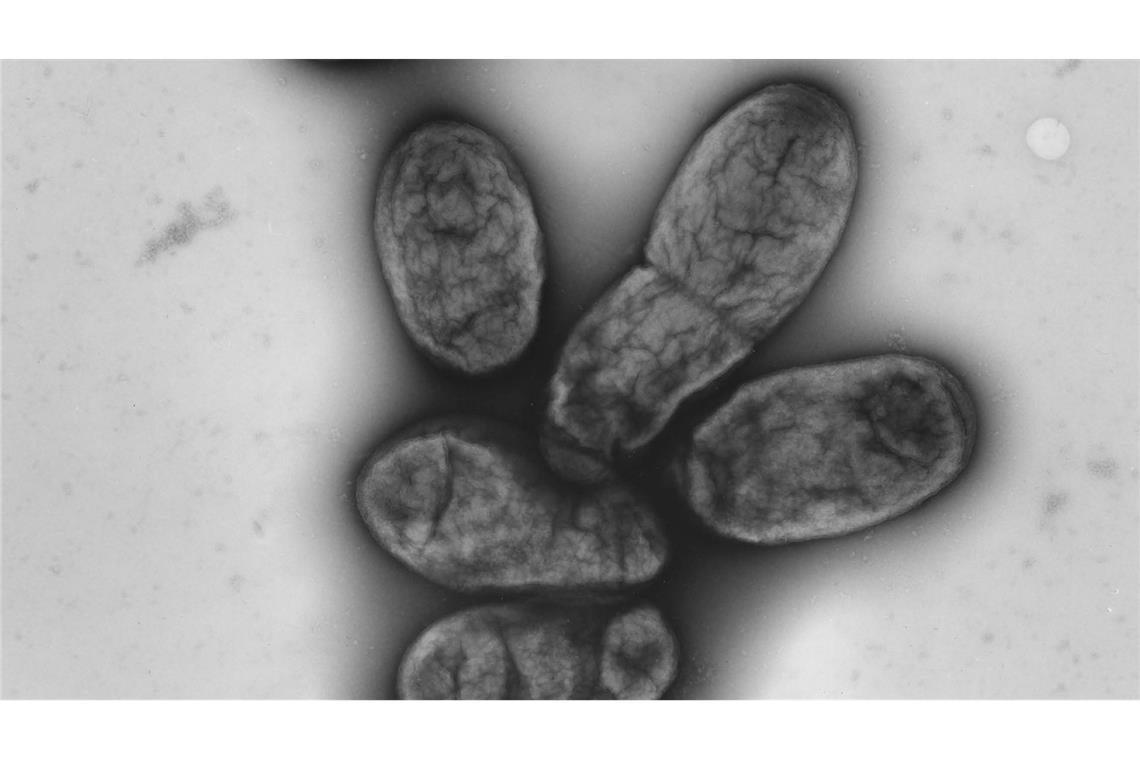 Pestinfektion in Kalifornien nachgewiesen Das Pestbakterium Yersinia pestis
