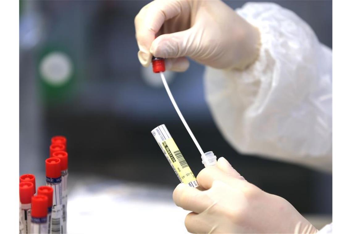 Gesundheitsamt: Bei 18 Betroffenen Corona-Mutation gefunden Das Wattestäbchen eines Corona Abstriches wird untersucht. Foto: Oliver Berg/dpa/Symbolbild