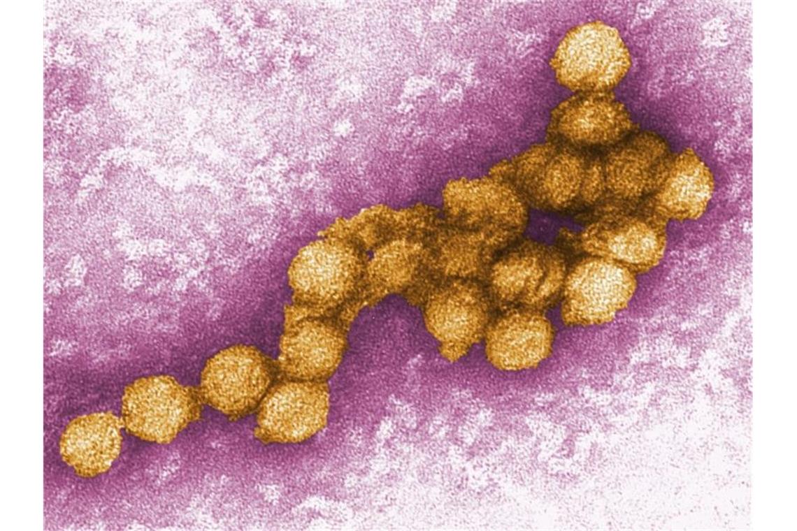 Das West-Nil-Virus unter dem Elektronenmikroskop. Erstmals ist in Deutschland eine durch Mücken übertragene Infektion beim Menschen nachgewiesen geworden. Foto: Cynthia Goldsmith/Centers For Disease Control/EPA