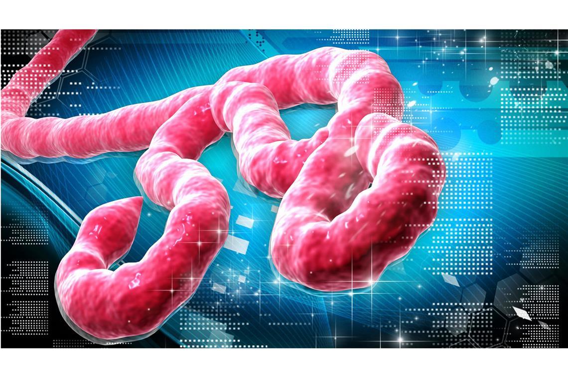 Wie Ebolaviren die Haut durchdringen Der Ebola-Erreger wird vor allem durch Körperflüssigkeiten wie etwa Blut, Urin, Speichel oder Erbrochenes übertragen.