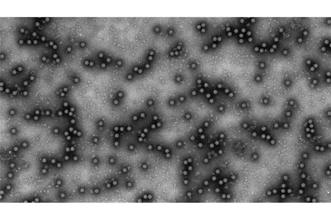 Wegen Tierseuche: Agrarbranche vor Grüner Woche unter Druck Der erstmalige Ausbruch des Virus in Deutschland seit rund 35 Jahren hat viele überrascht. (Archvibild)
