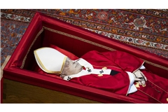 Der Leichnam von Papst Franziskus liegt im offenen Sarg im Petersdom im Vatikan, wo er drei Tage lang aufgebahrt sein wird. Vatikanquellen  berichten von einem Sturz, der auf der rechten Gesichtshälfte zu einem großen Hämatom geführt habe. Ein solches ist auch am aufgebahrten Leichnam deutlich zu sehen.