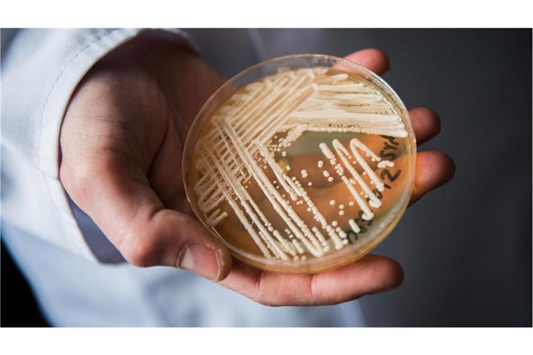 Der Leiter des Nationalen Referenzzentrums für invasive Pilzinfektionen, Oliver Kurzai, hält eine Petrischale mit dem Hefepilz Candida auris in den Händen. In Deutschland werden immer mehr Fälle bekannt, in denen schwer kranke Patienten mit dem gefährlichen Hefepilz Candida auris infiziert sind.