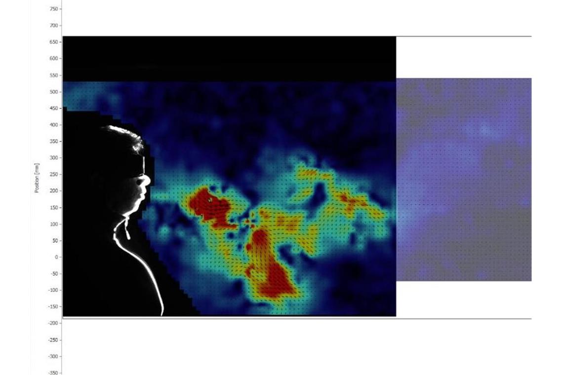 Die Atemluft eines ausatmenden Mannes ohne Mundschutz wird bei einem Versuch der Universität der Bundeswehr München erfasst und farblich dargestellt. Foto: Christian Kähler/Universität der Bundeswehr München/dpa