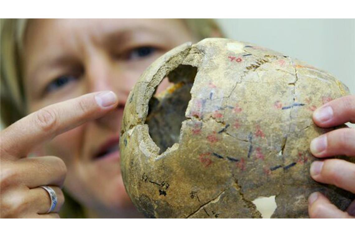 Die Blumenbachsche Schädelsammlung befindet sich im Zentrum Anatomie der Universitätsmedizin Göttingen. Die Sammlung wurde im 19. Jahrhundert von Johann Friedrich Blumenbach (1752-1840) begründet. Sie ist damit die älteste Schädelsammlung Deutschlands (Archivbild).