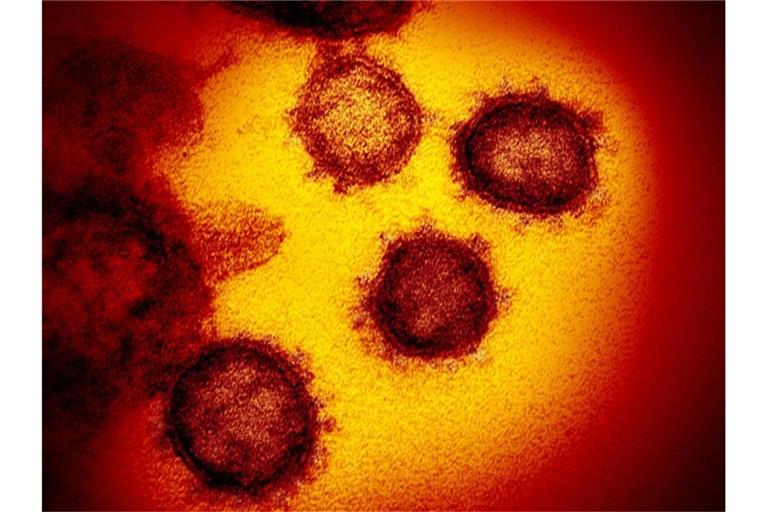 Die Elektronenmikroskopaufnahme zeigt das Coronavirus SARS-CoV-2. Foto: Niaid-Rml/ZUMA Wire/dpa