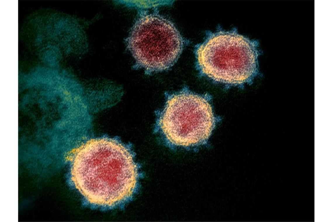 Die elektronenmikroskopische Aufnahme zeigt das Coronavirus. Foto: Uncredited/NIAID-RML/AP/dpa/Symbolbild