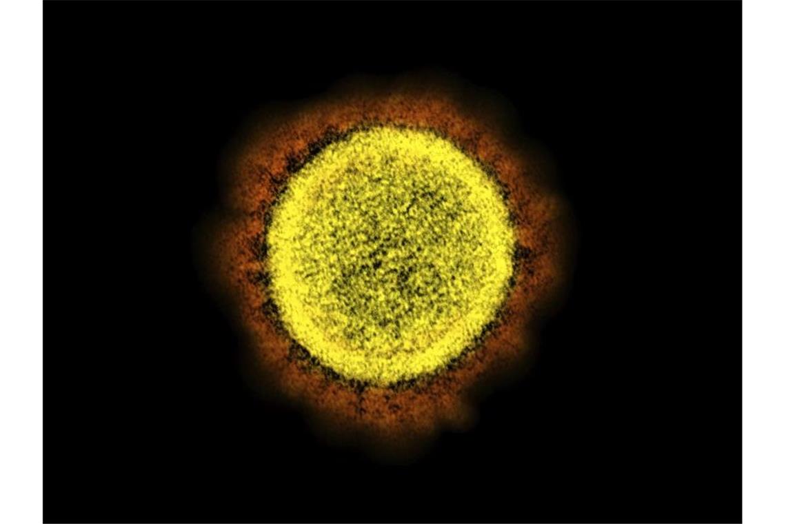 Die elektronenmikroskopische Aufnahme zeigt das Covid-19 verursachende Coronavirus SARS-CoV-2. Foto: -/NIAID/NIH/AP/dpa/Symbol
