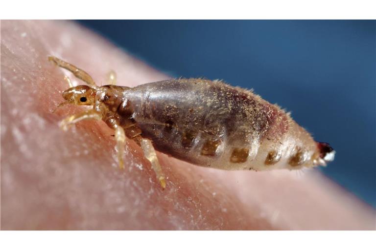 Das löste die größten Pest-Pandemien der Menschheitsgeschichte aus Die Kleiderlaus ist ein auf den Menschen spezialisierter blutsaugender Ektoparasit und  Überträger von Krankheitserregern wie dem Pest-Bakterium.
