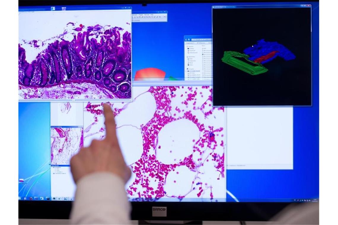 Die Krebs-Diagnostik rückt in Zeiten der Corona-Pandemie möglicherweise gefährlich in den Hintergrund. Foto: picture alliance / dpa