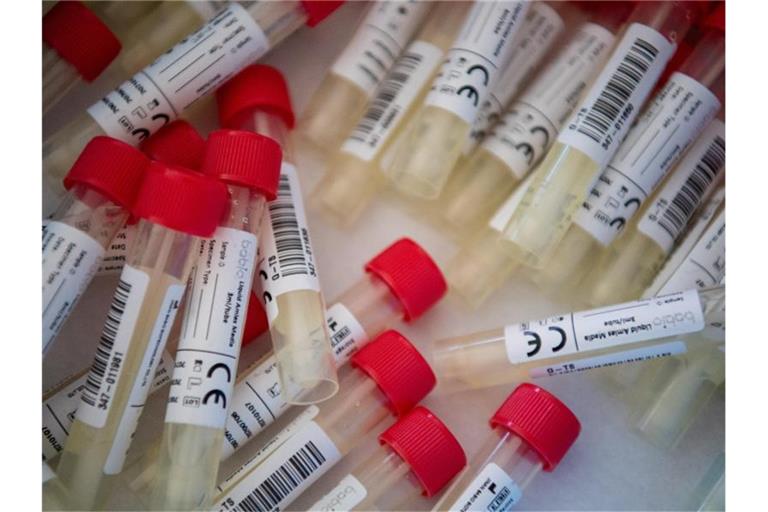 Die Zahl der täglichen Corona-Neuinfektionen in Deutschland erreicht ein bedenkliches Niveau. Foto: Sven Hoppe/dpa/Symbolbild