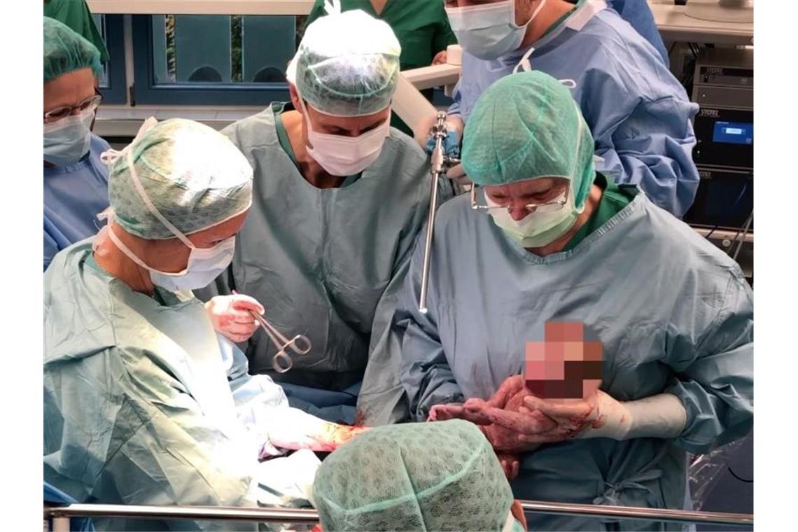 Kinder nach Gebärmutter-Transplantation geboren Ein Ärzteteam bei der Geburt eines Babys von einer Frau mit einer transplantierten Gebärmutter. Foto: Universitätsklinikum Tübingen