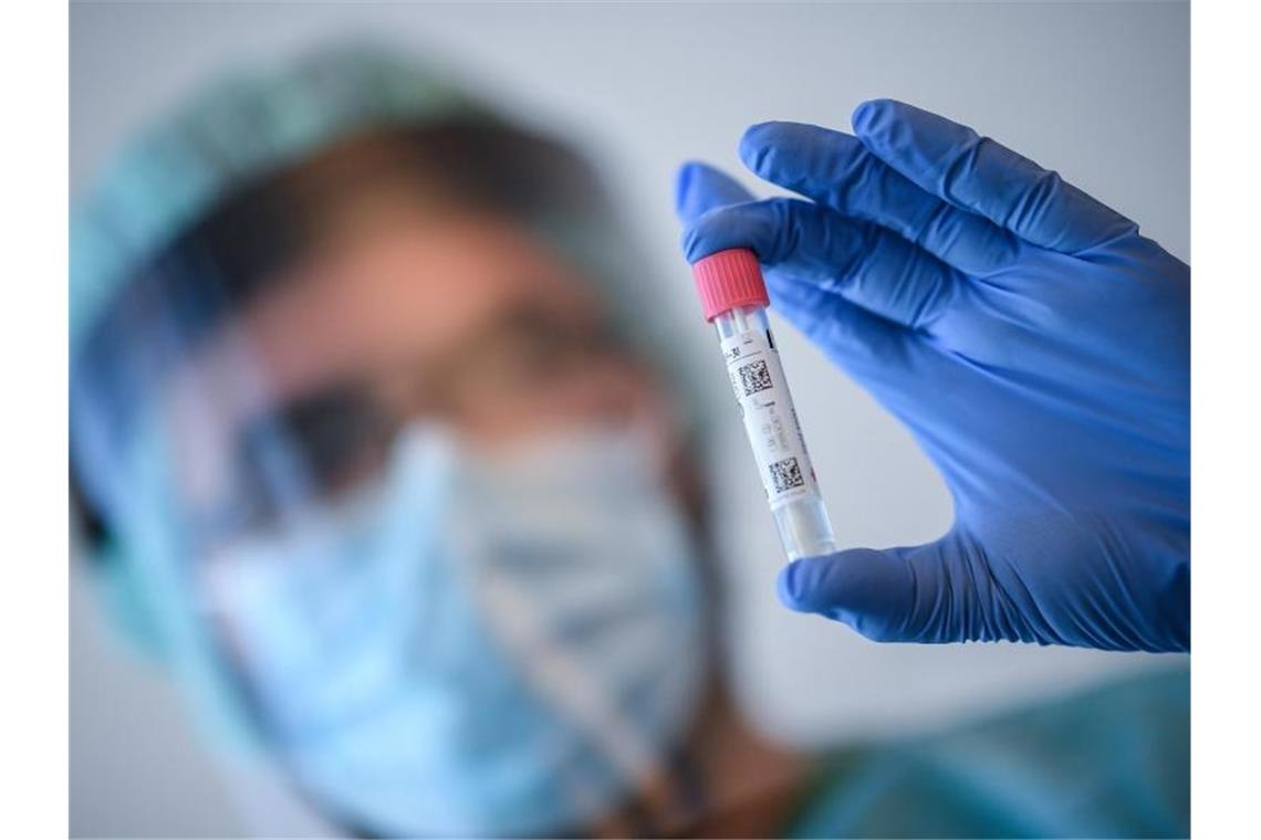 Ein Arzt nimmt in der Corona-Teststelle am Flughafen Schönefeld einen Abstrich für einen Coronavirus-Test. Foto: Britta Pedersen/dpa-Zentralbild/dpa