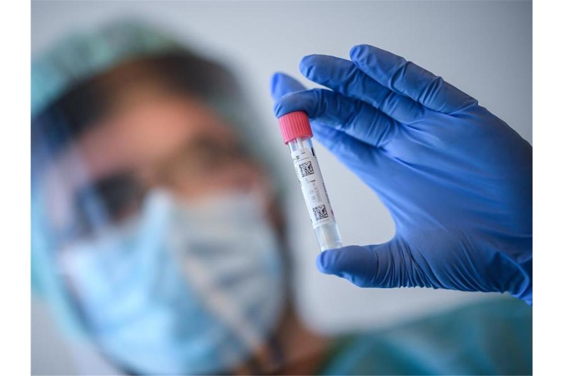 1192 Corona-Neuinfektionen in Deutschland registriert Ein Arzt nimmt in der Corona-Teststelle am Flughafen Schönefeld einen Abstrich für einen Coronavirus-Test. Foto: Britta Pedersen/dpa-Zentralbild/dpa