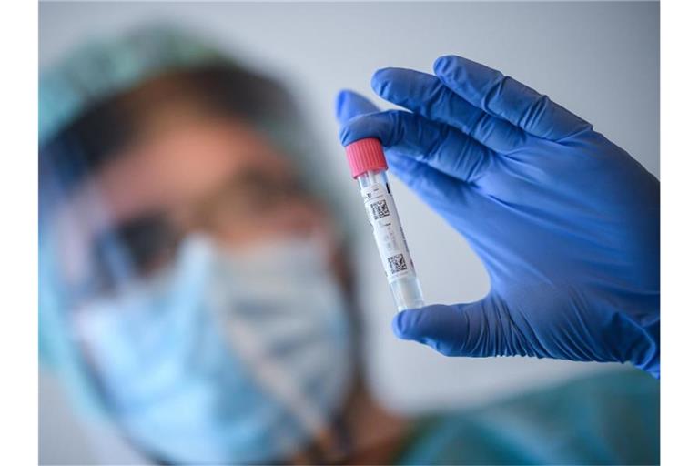 Ein Arzt nimmt in der Corona-Teststelle am Flughafen Schönefeld einen Abstrich für einen Coronavirus-Test. Foto: Britta Pedersen/dpa-Zentralbild/dpa