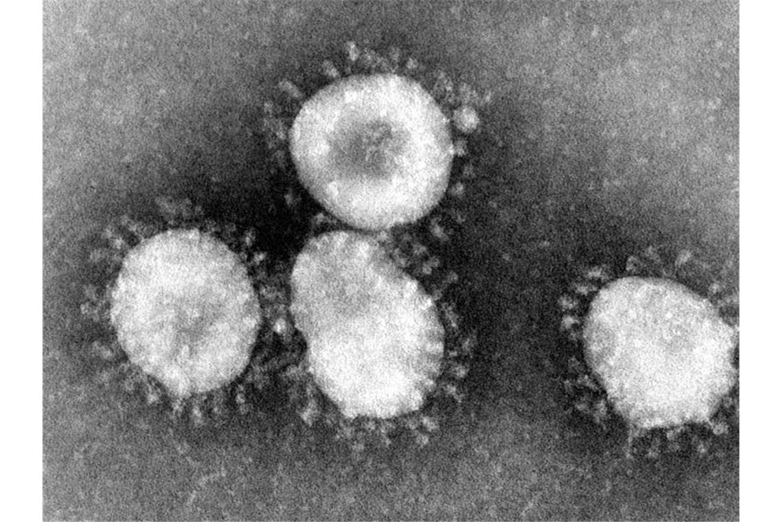 Ein Coronavirus unter dem Mikroskop. Foto: Center for Disease Control/epa/dpa