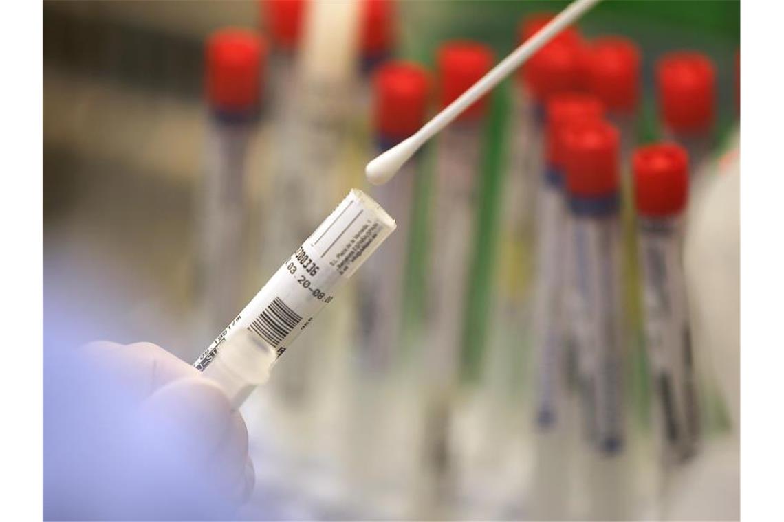 51 neue Corona-Infektionen im Südwesten Ein Covid-19-Test wird im Labor vollzogen. Foto: Oliver Berg/dpa/Symbolbild