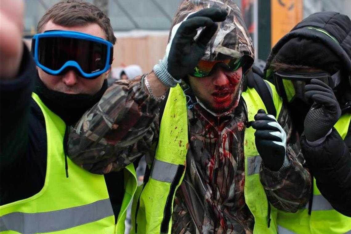 Ein Demonstrant der „Gilets Jaunes“ (Gelbwesten) ist mit Blut bedeckt, nachdem er bei den Auseinandersetzungen verletzt wurde. Foto: Thibault Camus/AP/dpa