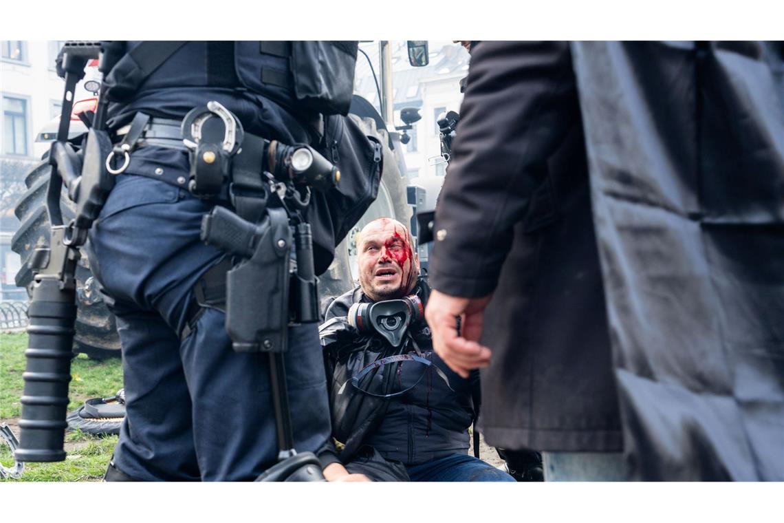 Ein Demonstrant sitzt verletzt auf einem Bordstein.