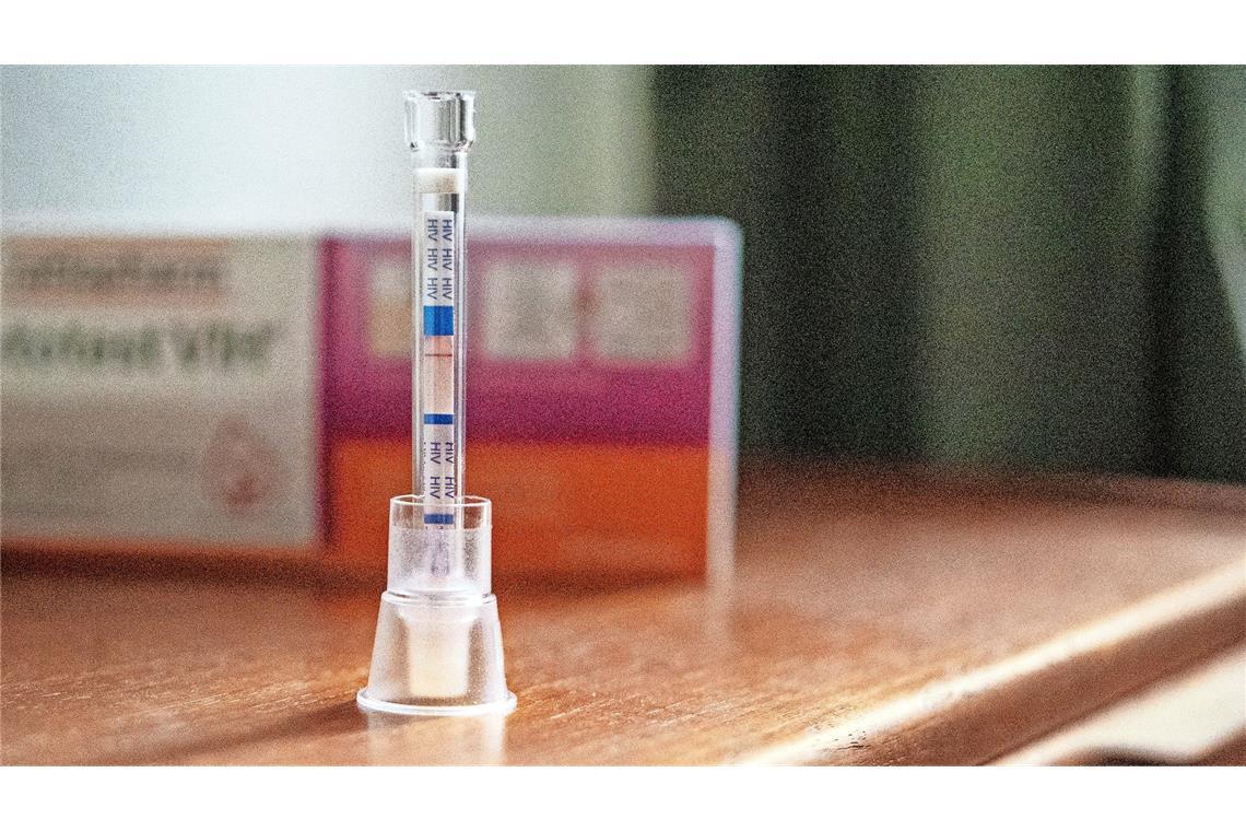 Ein HIV Selbsttest aus der Apotheke. (Symbolbild)