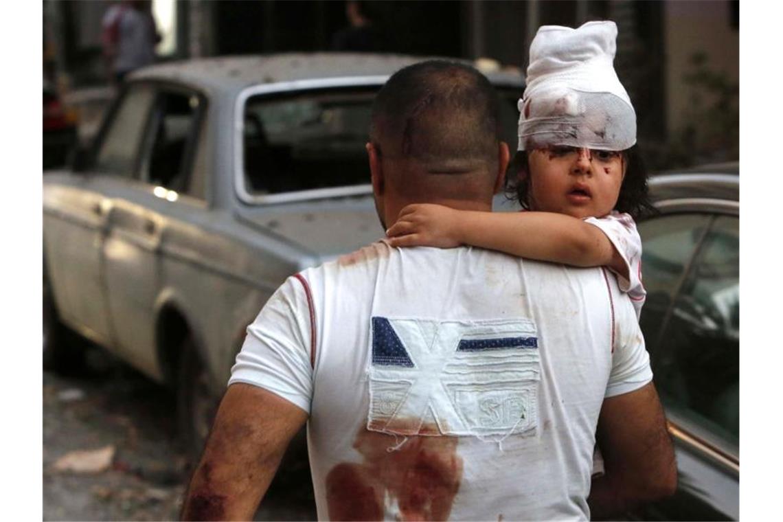 Ein Mann bringt ein verletztes Kind in Sicherheit. Foto: Marwan Tahtah/APA Images via ZUMA Wire/dpa