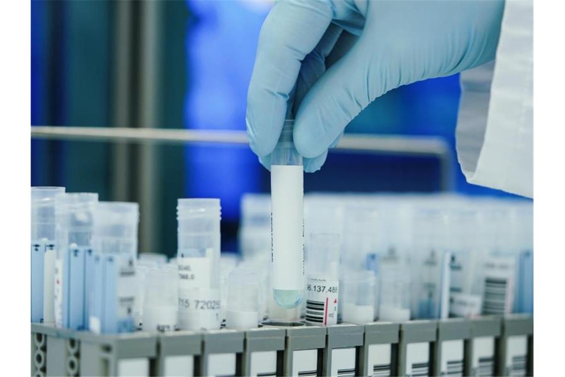 Gesundheitsminister: In vielen Fällen kein PCR-Test mehr