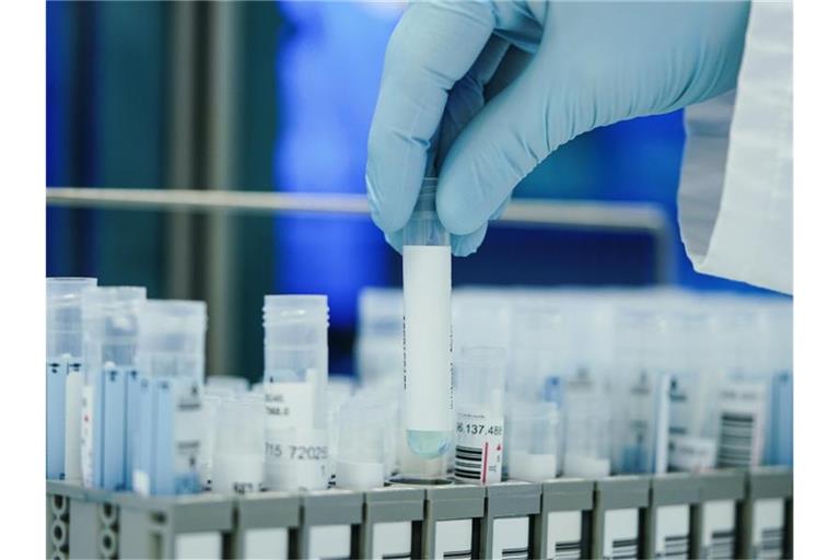 Ein Mitarbeiter in einem Coronatest-Labor mit PCR-Teströhrchen. Foto: Uwe Anspach/dpa
