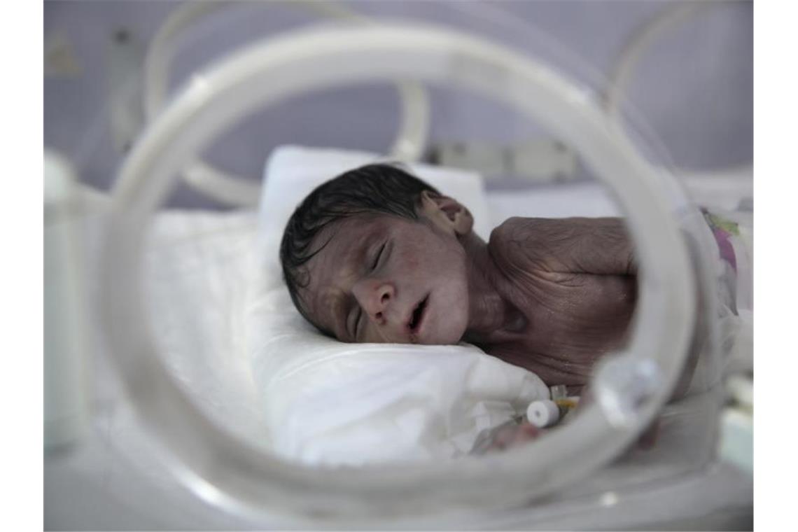 UN warnt vor Hungersnot im Jemen - Kritik an US-Terrorliste Ein unterernährtes Neugeborenes liegt in einem Inkubator im internationalen Krankenhaus UniMax in Sanaa. Foto: Hani Al-Ansi/dpa