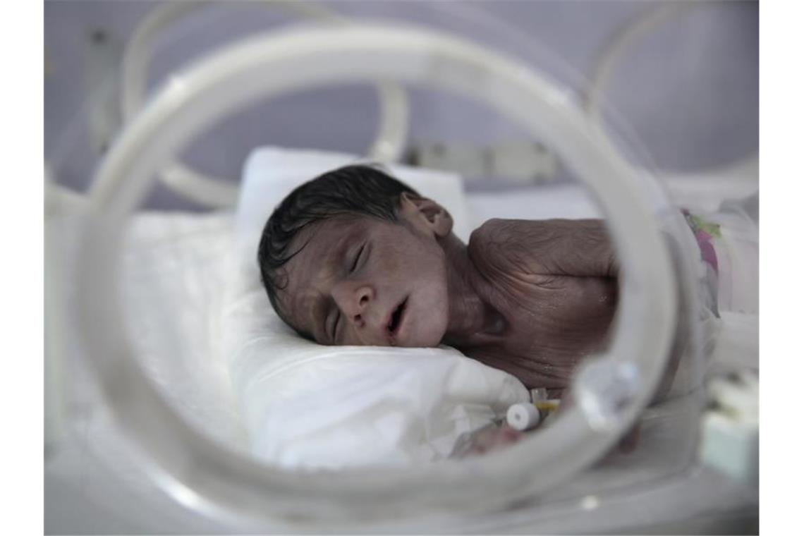 UN: Im Jemen droht Hunderttausenden Kindern der Hungertod Ein unterernährtes Neugeborenes liegt in einem Krankenhaus in Sanaa. Foto: Hani Al-Ansi/dpa