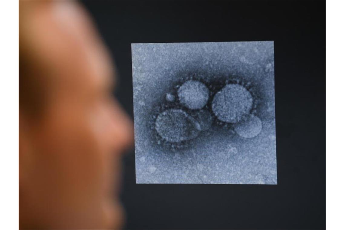 Ein Virologe betrachtet den MERS-Coronavirus. Foto: Arne Dedert/dpa/Archivbild