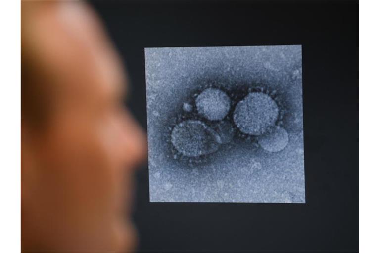 Ein Virologe betrachtet den MERS-Coronavirus. Foto: Arne Dedert/dpa/Archivbild