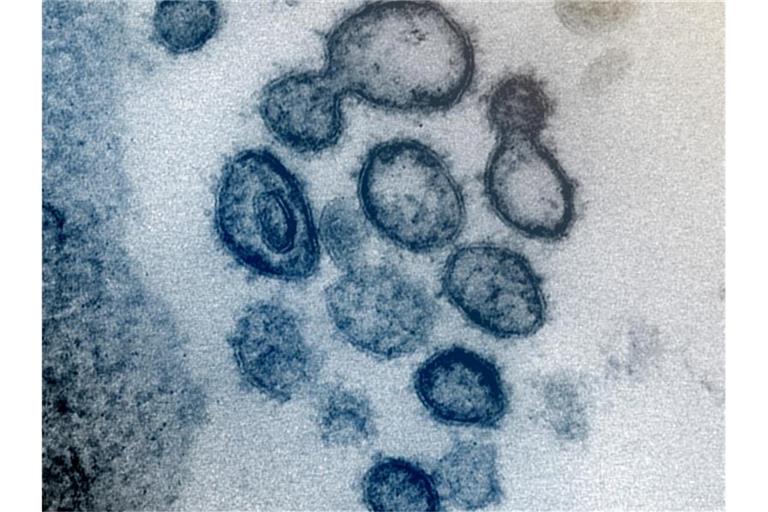 Eine Aufnahme eines Elektronenmikroskops zeigt das neuartige Coronavirus Sars-CoV-2. Foto: Uncredited/NIAID-RML/AP/dpa/Symbolbild